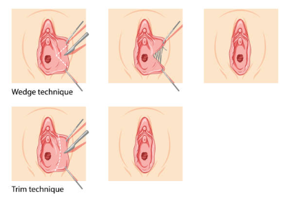 The vagina and its function in the female reproductive system - RealVagina